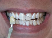 cosmetic dentistry video
