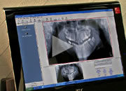 dental xrays video